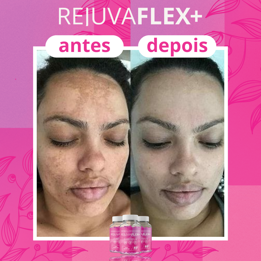 Antes-e-Depois-RejuvaFlex-01.png