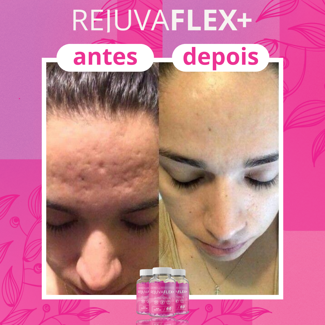 Antes-e-Depois-RejuvaFlex-24.png