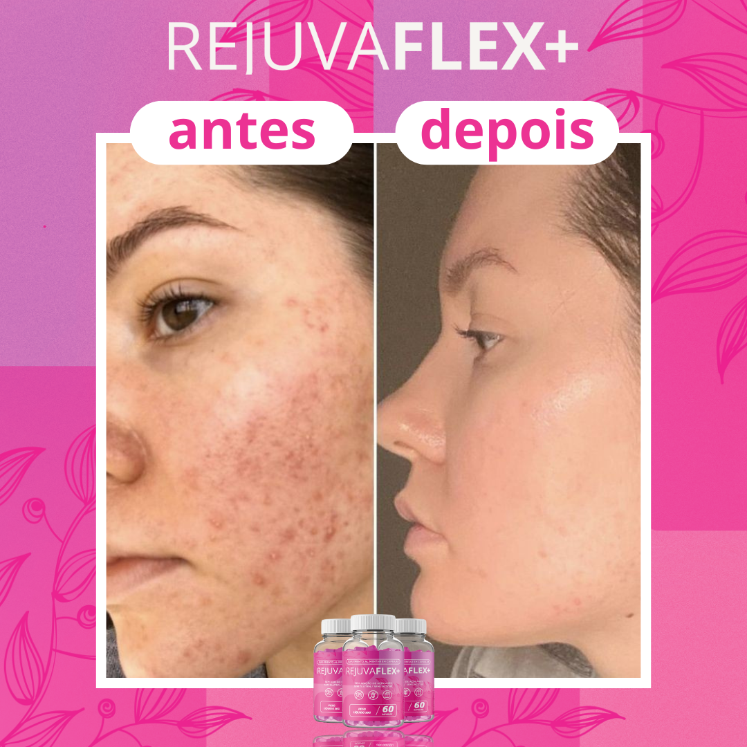 Antes-e-Depois-RejuvaFlex-26.png